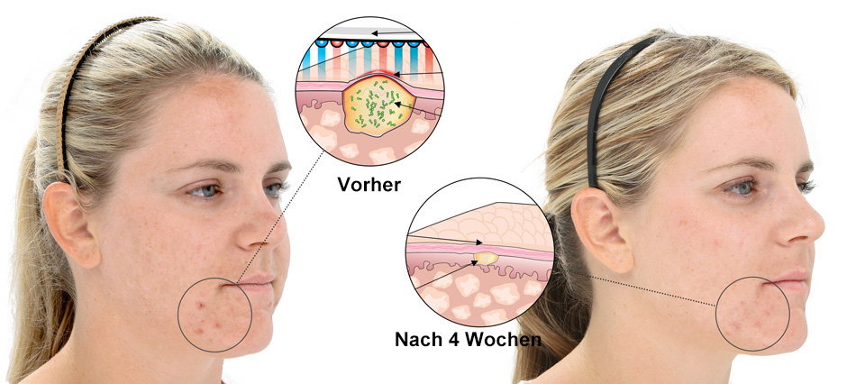 Cross-Section_Wrinkles