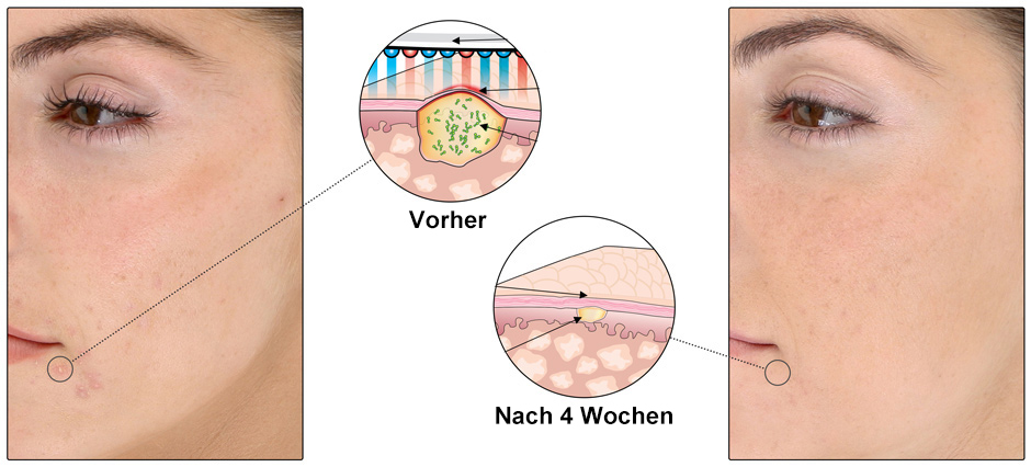 Cross-Section_Wrinkles