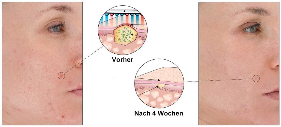 Cross-Section_Wrinkles